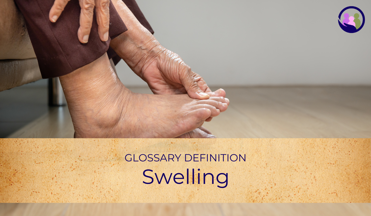 Swelling | Glossary Definition | Caregiver Bliss