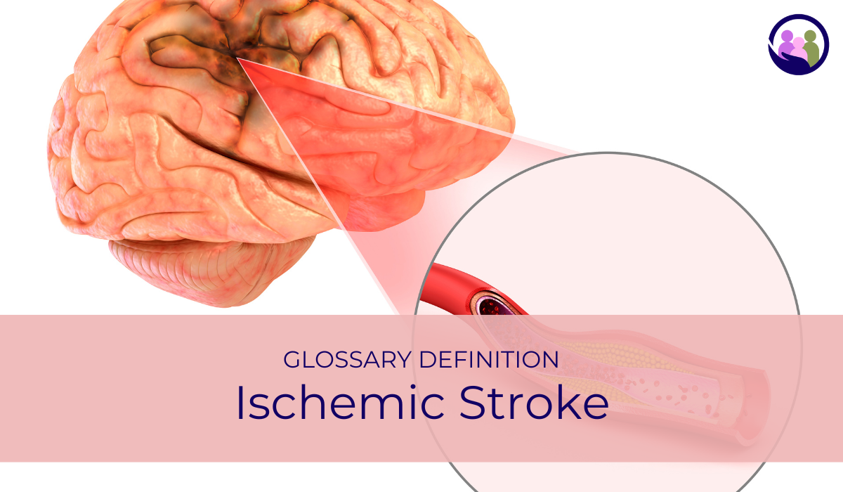 Ischemic Stroke | Glossary Definition | Caregiver Bliss