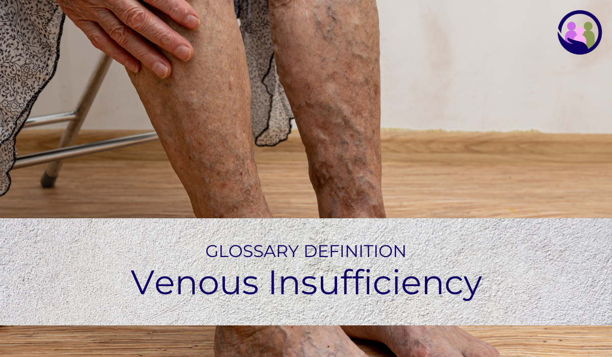 Venous Insufficiency | Glossary Definition | Caregiver Bliss